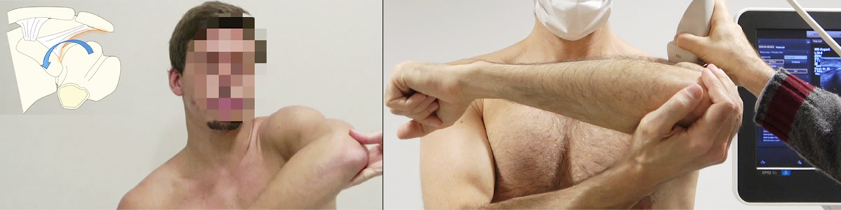 Shoulder and Elbow Diagnostic Maneuvers with Image Correlation