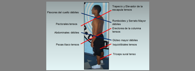 Evaluacion de la postura estática. Síndromes cruzados.