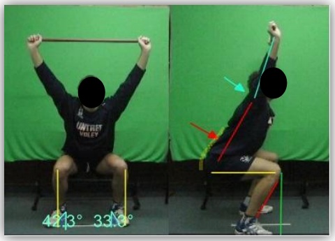 El uso del FMS (Functional Movement Screen) junto con la evaluación postural, como una simple herramienta para detectar riesgo de lesión y desbalances musculares en el voleibol (Parte I)