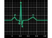 Efectos del Ejercicio Dinámico Máximo sobre el Electrocardiograma