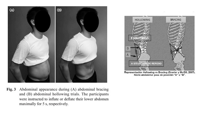 Análisis electromiográfico de los músculos abdominales durante las maniobras de bracing y hollowing abdominal entre seis posiciones diferentes