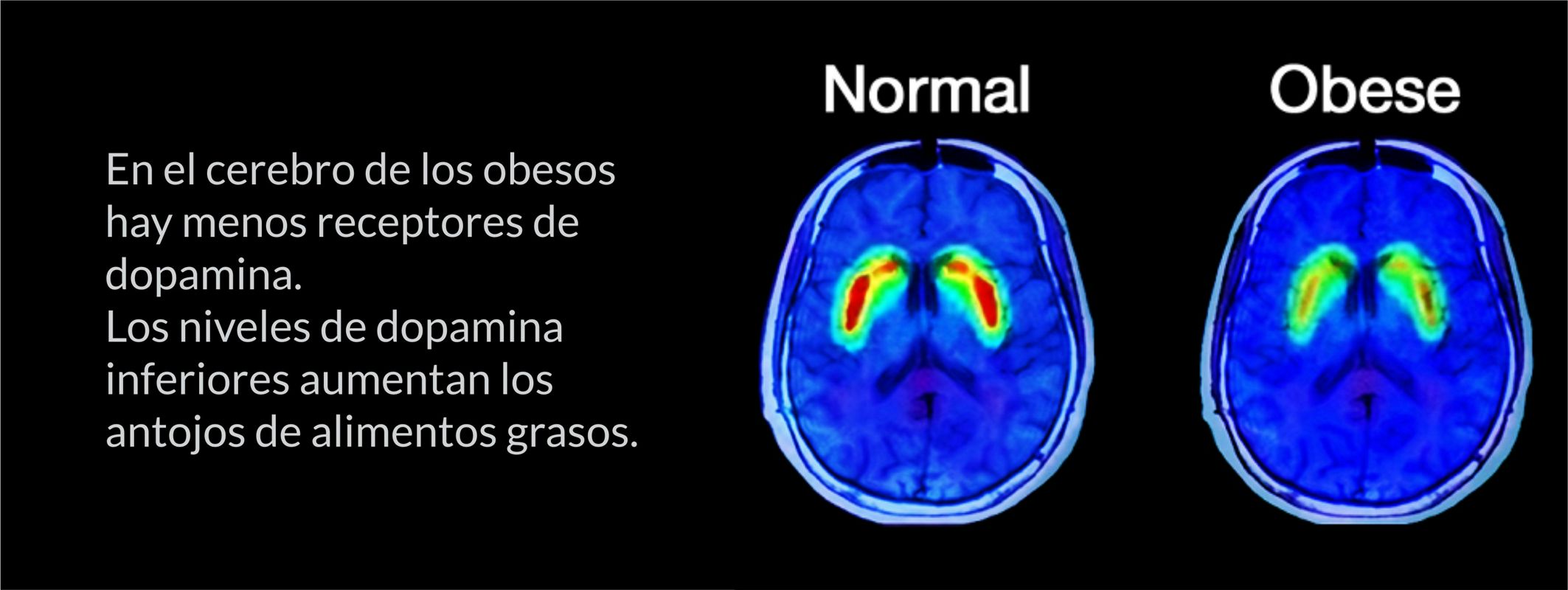 Mecanismos cerebrales de la Obesidad; Neurociencias para la Actividad Física.