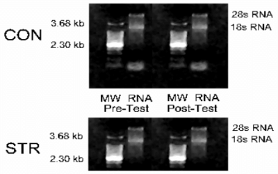 Efectos del Entrenamiento de Fuerza de Alta Intensidad sobre la Expresión del ARNm de la Isoforma de Miosina Pesada en Estado Estable
