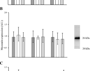 Los efectos de 52 semanas de entrenamiento de fútbol o resistencia en la composición corporal y la función muscular en machos sanos de +65 años: un ensayo controlado aleatorio