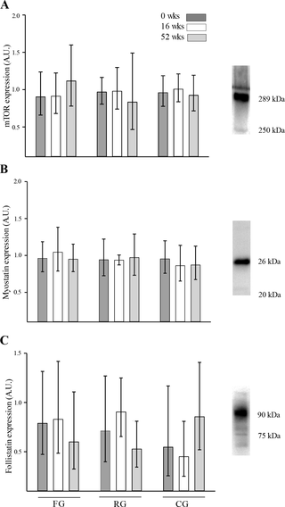 Los efectos de 52 semanas de entrenamiento de fútbol o resistencia en la composición corporal y la función muscular en machos sanos de +65 años: un ensayo controlado aleatorio