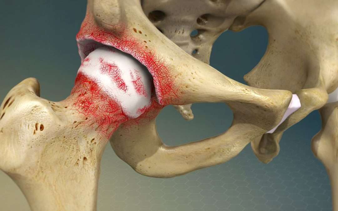 Ejercicio Físico en la Osteoartritis: una intervención de primera línea con respaldo científico