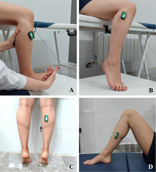 El programa integral de ejercicio correctivo mejora la función del tobillo en atletas femeninas con dorsiflexión de tobillo con peso limitado: un ensayo controlado aleatorio