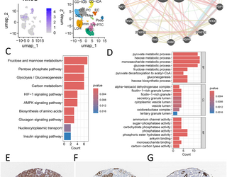 Una firma de diagnóstico urinario no invasivo para la enfermedad renal diabética revelada mediante aprendizaje automático y análisis unicelular