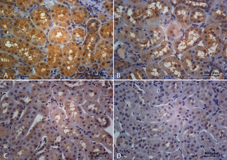 Efecto Beneficioso del Ejercicio Moderado en el Riñón de la Rata tras el Consumo Crónico de Bebidas de Cola