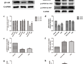 El ejercicio aeróbico protege contra la disfunción cardíaca y la hipertrofia inducidas por sobrecarga de presión a través de la activación de β3-AR-nNOS-NO