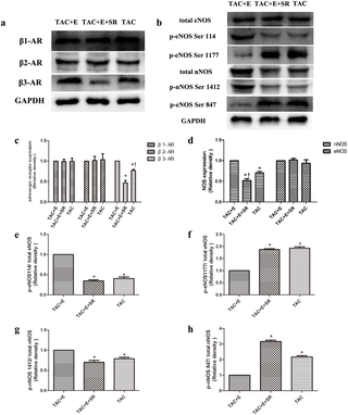 El ejercicio aeróbico protege contra la disfunción cardíaca y la hipertrofia inducidas por sobrecarga de presión a través de la activación de β3-AR-nNOS-NO