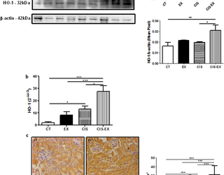 El ejercicio aeróbico a largo plazo protege contra la nefrotoxicidad inducida por cisplatino al modular la expresión de IL-6 y HO-1