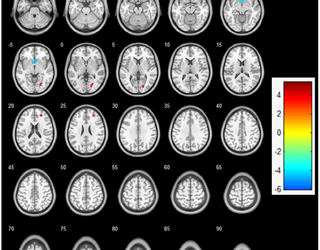 El ejercicio aeróbico agudo aumenta la actividad cortical durante la memoria de trabajo: un estudio de resonancia magnética funcional en estudiantes universitarias