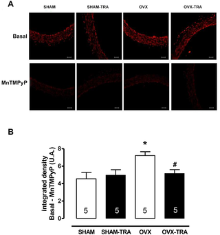 El entrenamiento de ejercicio aeróbico previene el inicio de la disfunción endotelial a través del aumento de la biodisponibilidad de óxido nítrico y la reducción de especies reactivas de oxígeno en un modelo experimental de menopausia