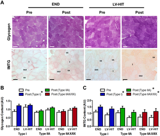Respuestas Específicas de las Fibras al Entrenamiento de Endurance y al Entrenamiento en Intervalos de Alta Intensidad de Bajo Volumen: Similitudes Notables en la Adaptación Aguda y Crónica